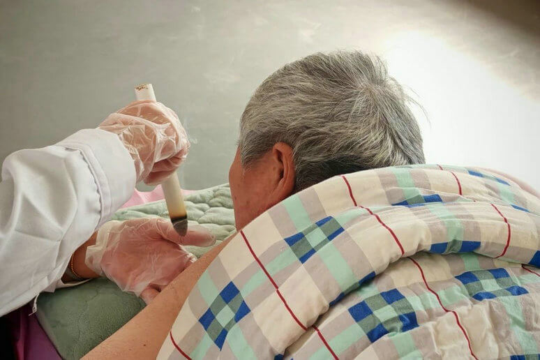 万家安护理站艾灸服务火热开启！